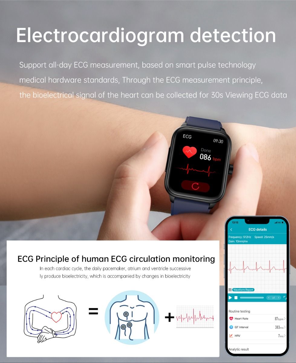 ET540 Blodsocker EKG Kroppstemperatur Blodtryck Blodsyre Puls Bluetooth-samtal Smartklocka Träningsspårare