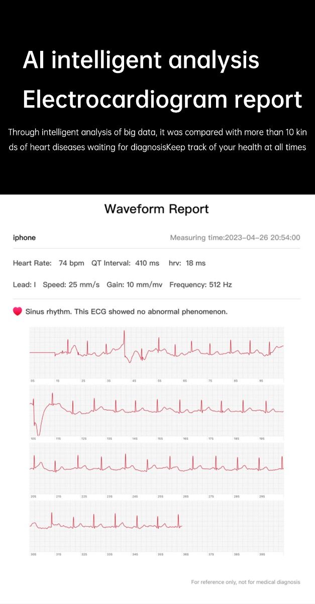 ET540 Blodsocker EKG Kroppstemperatur Blodtryck Blodsyre Puls Bluetooth-samtal Smartklocka Träningsspårare