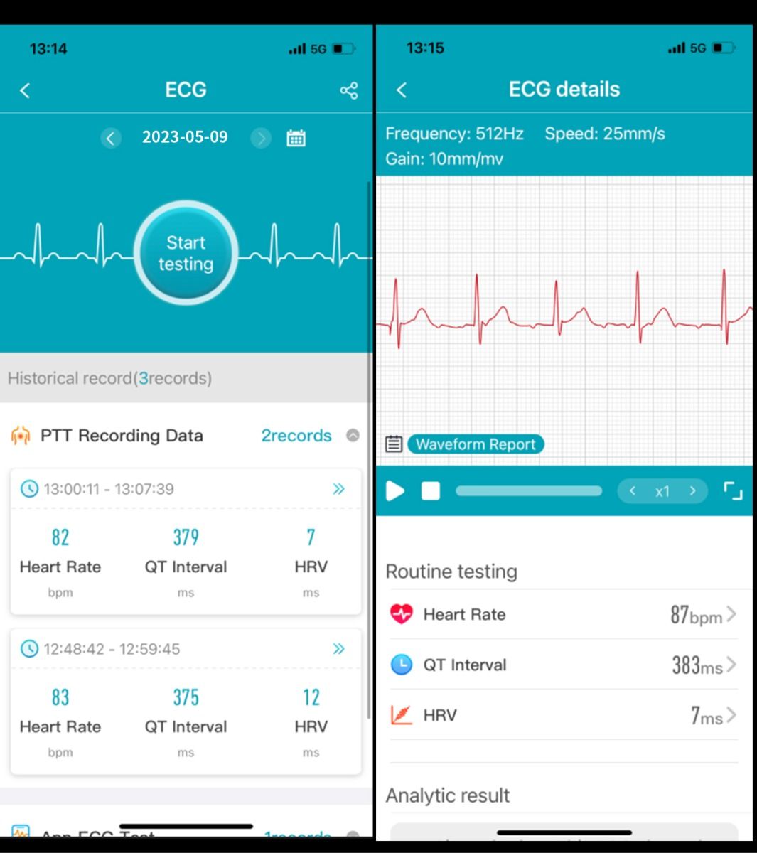 ET540 Blodsocker EKG Kroppstemperatur Blodtryck Blodsyre Puls Bluetooth-samtal Smartklocka Träningsspårare